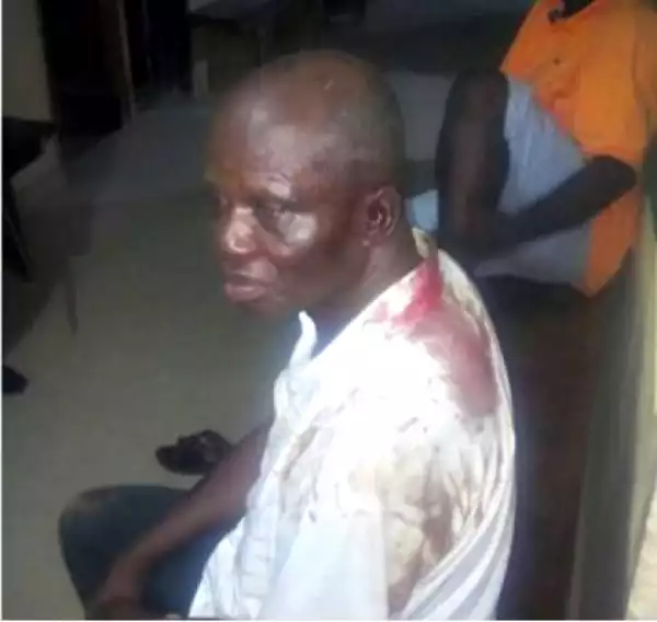Too Brutal: How Armed Robbers Attacked Players & Officials of Osun United FC (Photo)